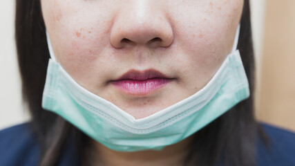 The half-face picture of a woman wearing a mask under her chin is misguided wearing.