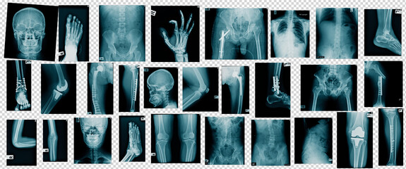 hight quality collection x-ray image
