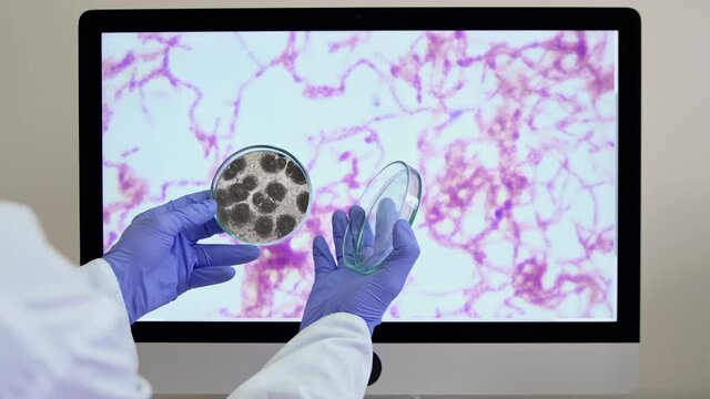 Lab assistant in gloves looks at colony of bacteria in Petri dish near large image on screen in researching laboratory close view