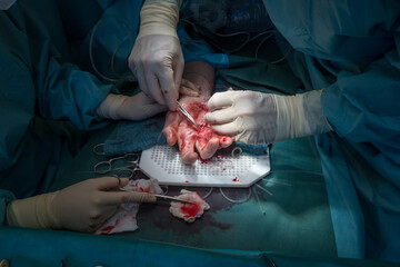 doctor performs a hand surgery operation