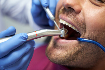 Fragment photo of dental drill in use on man teeth