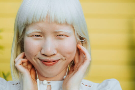 Cute albino girl listening to her favorite music through earphones