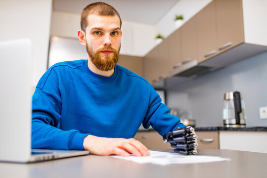 man with prosthetic hand writing development at home