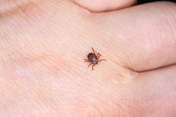 A tick on a man's hand is looking for where to bite.