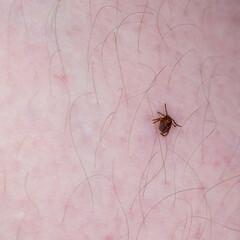 The tick on the leg is looking for where to bite.