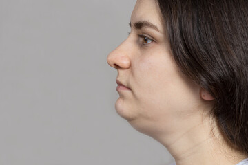 The woman has a double chin. Treatment, chin reshaping, fat removal, lifting. Place for text copy...