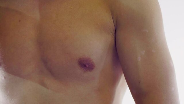 homme, psoriasis, ecz&eacute;ma, probl&egrave;me de peau, m&eacute;dicale, corps, femme, nu, sein, beaut&eacute;, jeune, beau, peau, torse, poitrine, sant&eacute;, blanc, mod&egrave;le, fitness, musculaire, mince, isol&eacute;, sain, arri&egrave;re, main, 