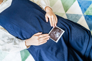 赤ちゃんのエコー写真を持った妊婦の写真。妊娠中のイメージ。