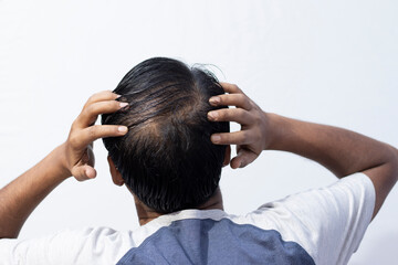 Naklejka premium hair fall problem for men