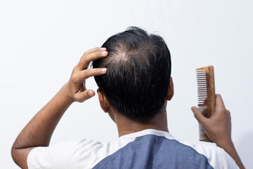 hair fall problem for men - obrazy, fototapety, plakaty