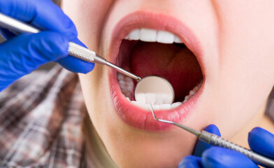 Taking care of teeth. Woman at the dentist. Dental care, taking care of teeth. Girl having teeth...