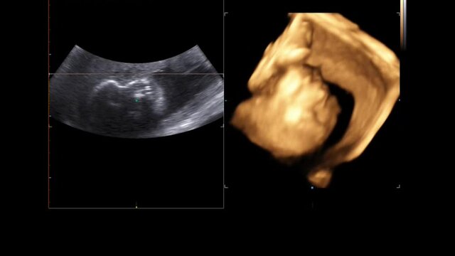 Motion of 4D Ultrasound Echography of baby un mother's womb. Life concept, scientific discovery
