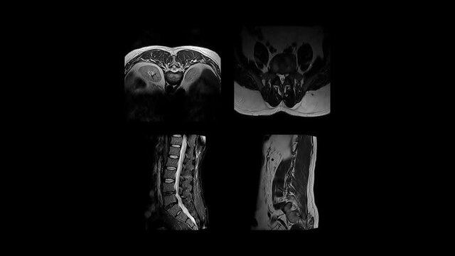 MRI close-up monochrome images scan organs of different parts of the human body