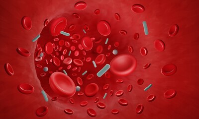 Bacteremia, bloodstream infection, bacteria in blood