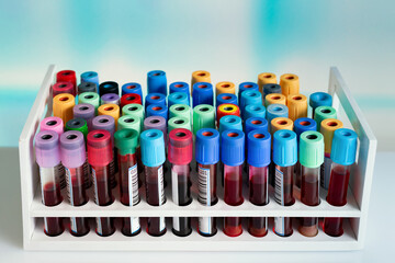 rack with tubes with blood samples taken from patients for analysis in the laboratory. Tray with...