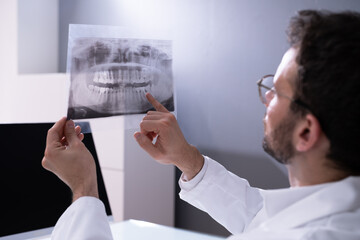 Wisdom Teeth Dental X Ray Image
