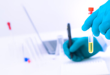 A test tube with yellow urine inside, a red cap, and a blue glove-wearing doctor's hand. Saving data Background with experimental equipment On the white table, the concept of drug testing
