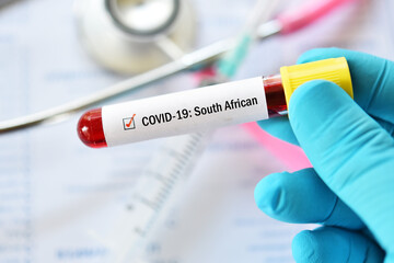 South African COVID-19 variant, blood sample tube positive with South African strain of COVID-19 virus 
