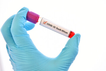 Obraz premium South African COVID-19 variant, blood sample tube positive with South African strain of COVID-19 virus 