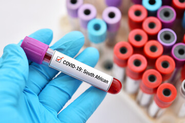 Fototapeta premium South African COVID-19 variant, blood sample tube positive with South African strain of COVID-19 virus 