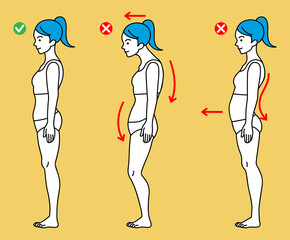 Three types standing posture - Women - obrazy, fototapety, plakaty