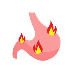 Heartburn. Stomach disease. Internal organ on fire. Gerd, gastric ulcer, acid reflux, gastritis,  indigestion. Vector flat cartoon illustration