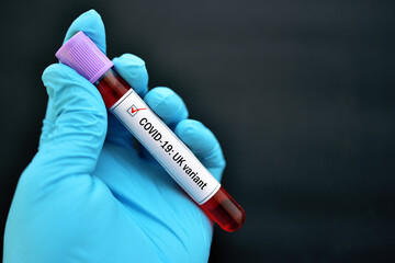 UK variant of COVID-19, blood sample tube positive with UK strain of COVID-19 virus 