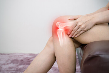 Human leg osteoarthritis inflammation of bone joints - obrazy, fototapety, plakaty