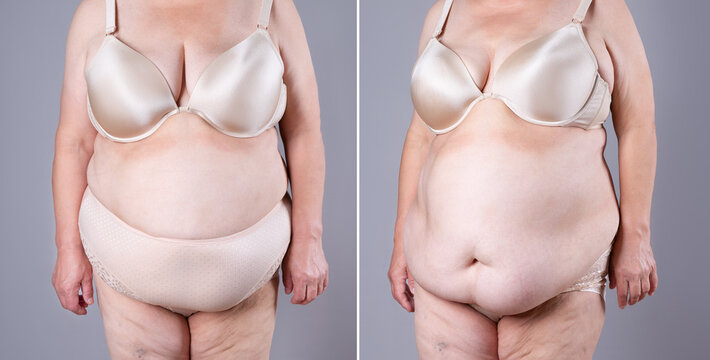 Woman's body before and after weight loss on gray background