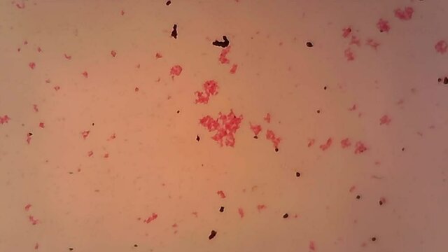 Microscope Bacillus Smear x1200