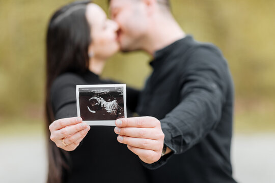 two hands are holding an ultrasound image of a baby. Concept of desire for children, pregnancy, love, family and child birth. Parents look forward to the child that will soon be born. A couple is kiss
