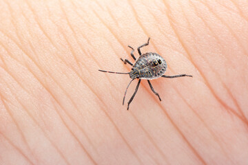 Sucking tick Macro photo on human skin. Ixodes ricinus. Bloated parasite bitten into pink irritated epidermis. Small red drops. Dangerous insect mite. Encephalitis, Lyme disease infection.    