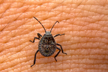 Sucking tick Macro photo on human skin. Ixodes ricinus. Bloated parasite bitten into pink irritated epidermis. Small red drops. Dangerous insect mite. Encephalitis, Lyme disease infection.    