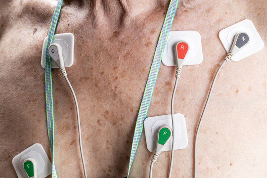 cardiology monitoring equipment ecg holter monitor. senior adult men with cardio monitor on his chest. 24 hours cardio recorder