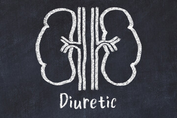 Chalk drawing of human kidneys and medical term Diuretic. Concept of learning medicine - obrazy, fototapety, plakaty