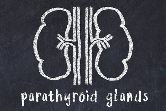Chalk drawing of human kidneys and medical term parathyroid glands. Concept of learning medicine