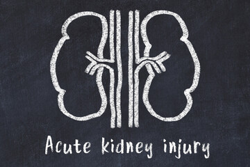 Chalk drawing of human kidneys and medical term Acute kidney injury. Concept of learning medicine