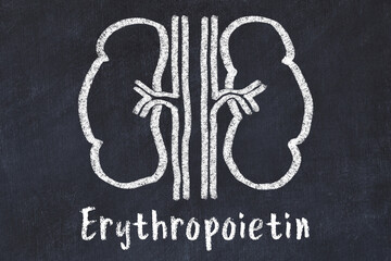 Chalk drawing of human kidneys and medical term Erythropoietin. Concept of learning medicine