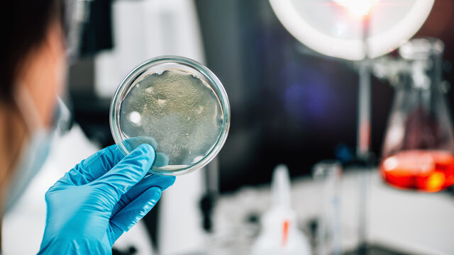 Assessment of Fish Quality. Microbiologist Examining a Petri Dish with Agar