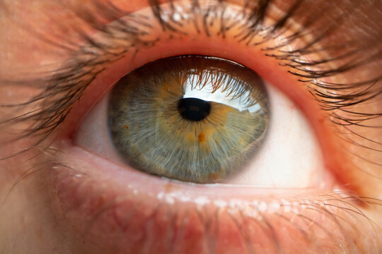 Extreme Macro Detailed Close Up Of A Human Eye With Central Heterochromia -different Colored Iris: Blue, Grey And Brown