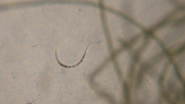 Bacteria Parasites and Worms in drinking Water under Microscope. nematode Worm under Microscope, Parasites Among Roundworms: Roundworms, Pinworms, Trichinella. Environmental Pollution.
