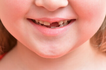 Fototapeta premium Child smile with first baby tooth that has fallen out