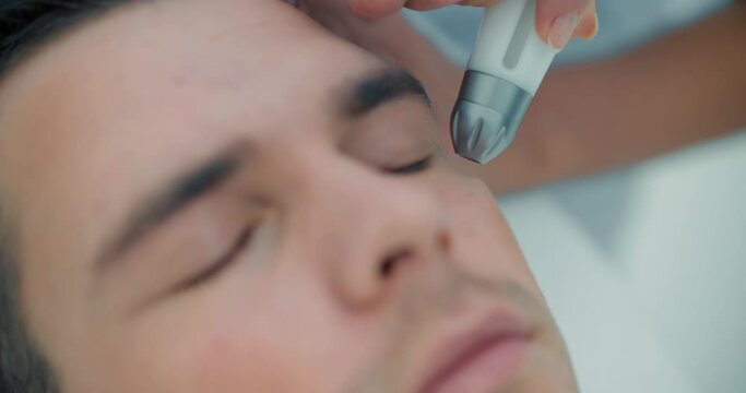 Close-up face of a male client who is having a non-injection mesotherapy procedure on his eyelid by using Dermadrop TDA device.