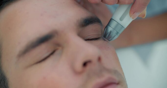Close-up face of a male client who is having a non-injection mesotherapy procedure on his eyelid by using Dermadrop TDA device.