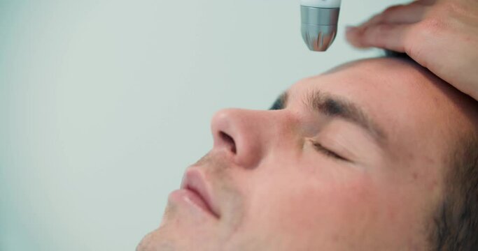 Close-up face of a male client who is having a non-injection mesotherapy procedure on his forehead by using Dermadrop TDA device.