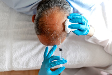 Man with hair loss problem receiving injection in head by young female doctor. Treatment of...