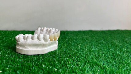 Veneers of the front teeth on the diagnostic model on artificial grass, side view