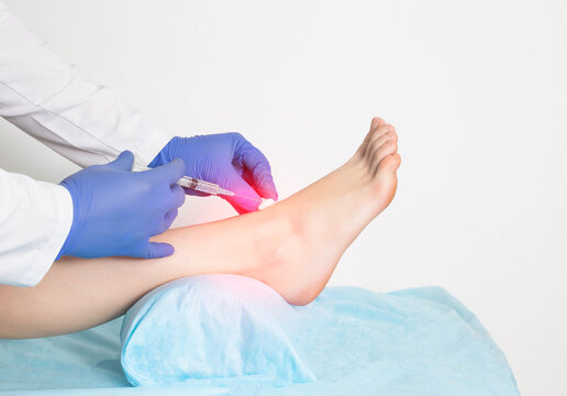 The doctor gives an intra-articular injection of an ankle block to a patient who has a ligament rupture and injury, close-up
