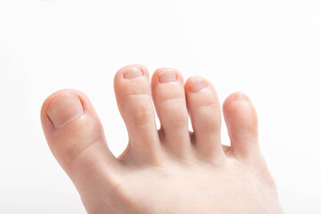 Toes on a white background. Concept of unpleasant foot odor, bacteria and fungus between the toes