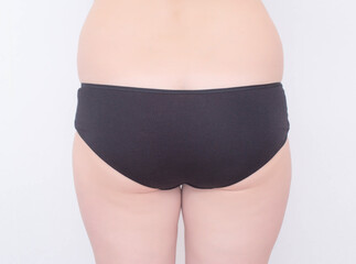 Girl in black panties with cellulite and sagging fat folds on a white background. Lipofilling and liposuction concept, close-up